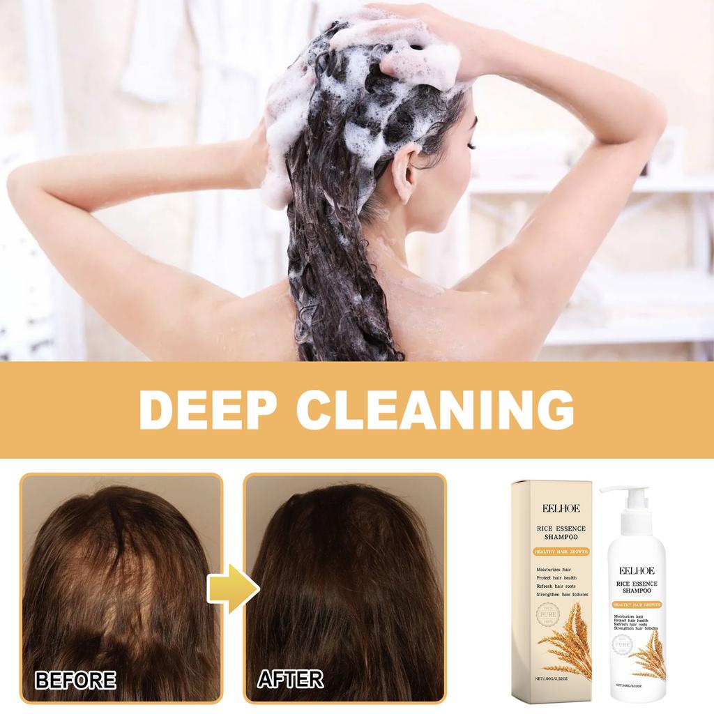 Rice Anti Shedding Shampoo Deeply Cleanses, Moisturizes, and Repairs Hair Roots, Strengthens Hair, and Prevents Loss of Dense Hair
