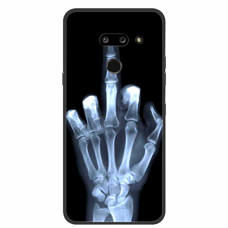 Für LG G8 G8S ThinQ Schwarze Hüllen Weiche Silikon TPU Handyhüllen Für G 8 S 8S ThinQ Luxus Rückabdeckung Funda Cartoon Schale Para Capa