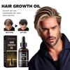 Hair Growth Oil, Protect Hair Follicle Moisture Nutrition Hair Root Strength Thick Hair Essence