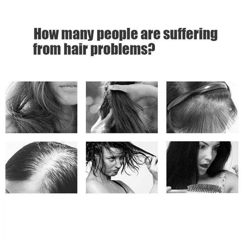 Buy Ginger King 7 Days Hair Essential Oil Hair Care Oils Hairdressing Hair Mask Essential Oil at