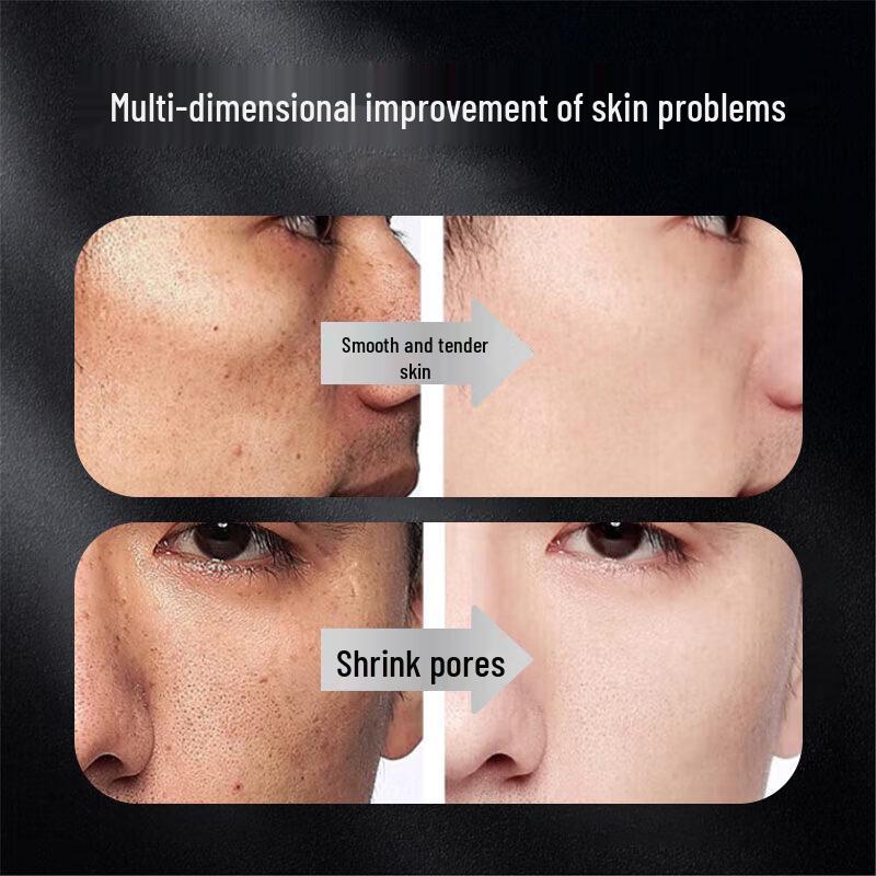 Sakose Vaseline Salicylic Acid Vitamin B5 Men's Face Mask