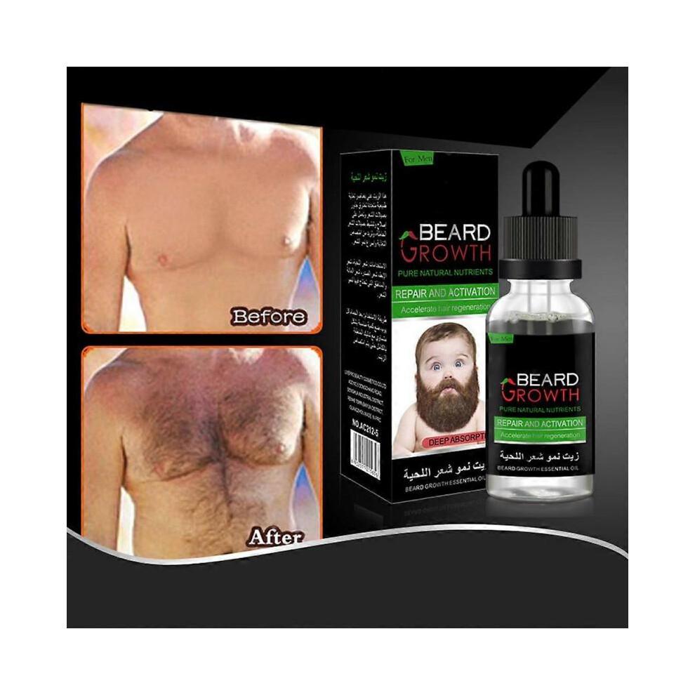 2 uds Crecimiento de Pelo de Barba Regeneración Reparación Nutrientes Naturales 30ml