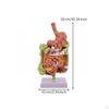 Intestinal Pathology Model Colored Details Human Colon Anatomy Anatomical