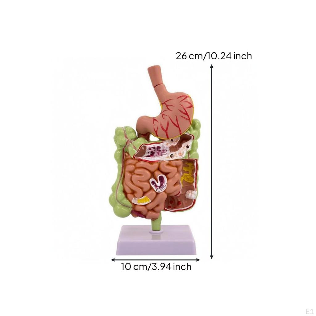 Intestinal Pathology Model Colored Details Human Colon Anatomy Anatomical