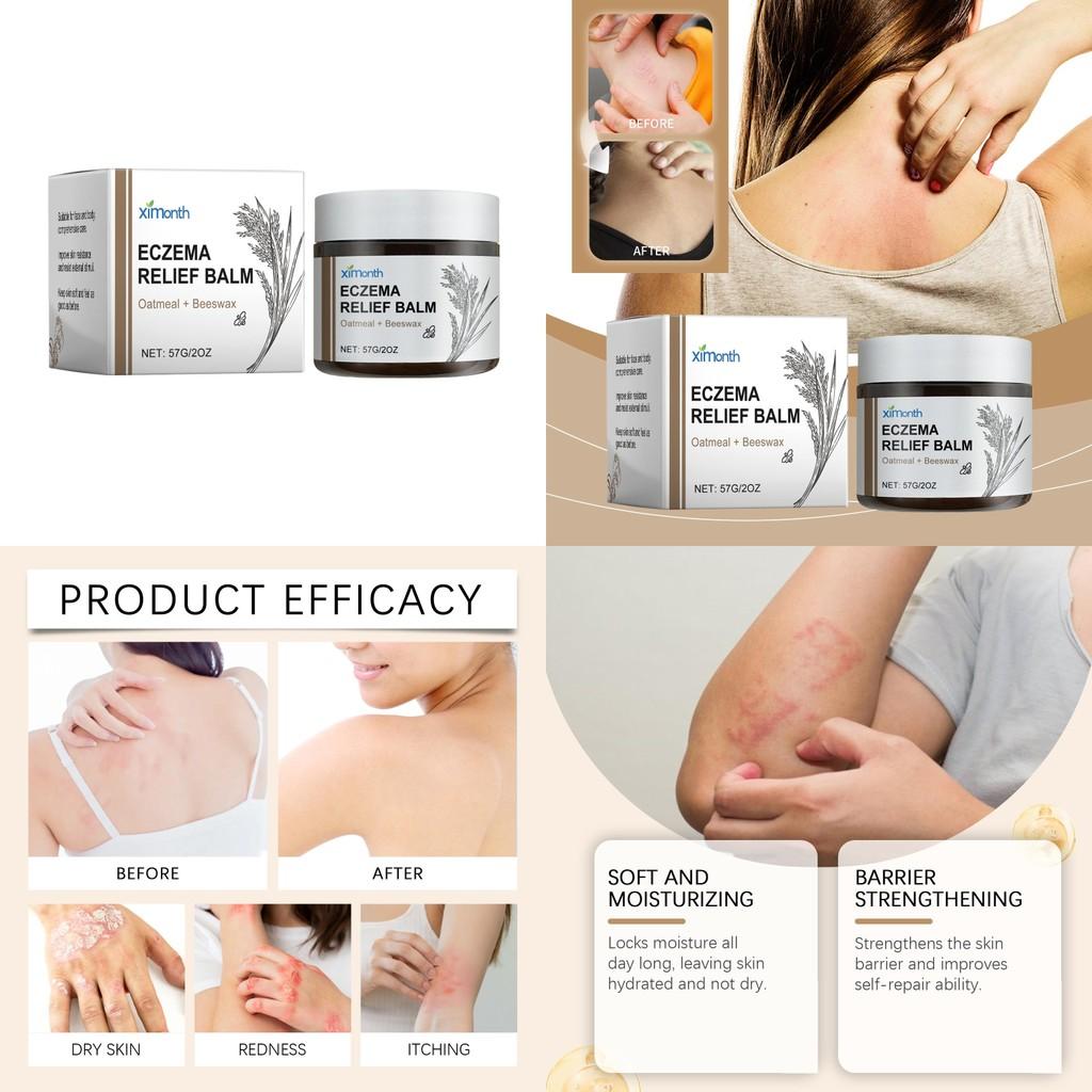 Ximonth Skin Care Cream Gentle Formula Daily Moisturizing Nourishing Cream For All Skin Types