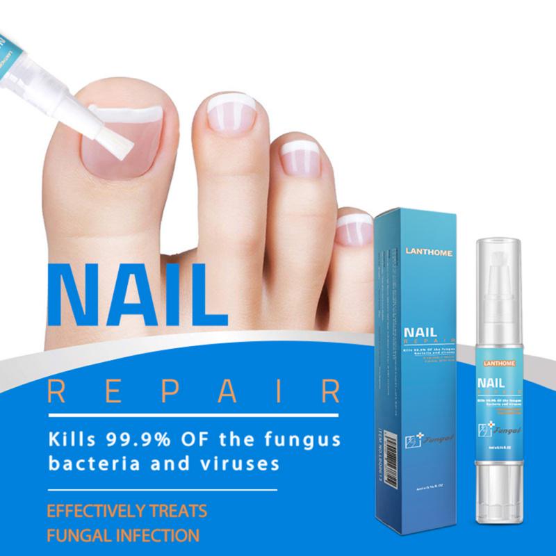 Buy Nail Repair Liquid Elimination Of Nail Fungus Remove Onychomycosis