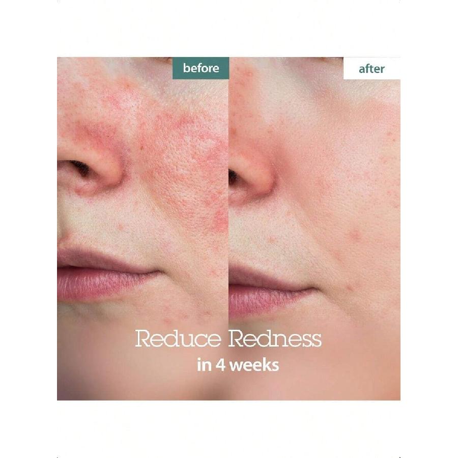 Blithe Pressed Serum Chaga Mushroom 27ml Advanced Skin Tightening Cream For Face Face Tightening And Lifting Formula For A Natural Face Lift