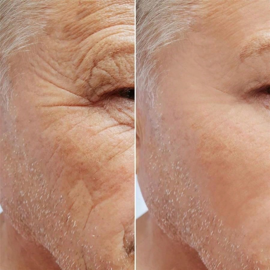 5g/15g/30g/50g /60gRelief Pain Back Pain Muscle Aches Sprain Arthritic Pains Muscle Pain Cream