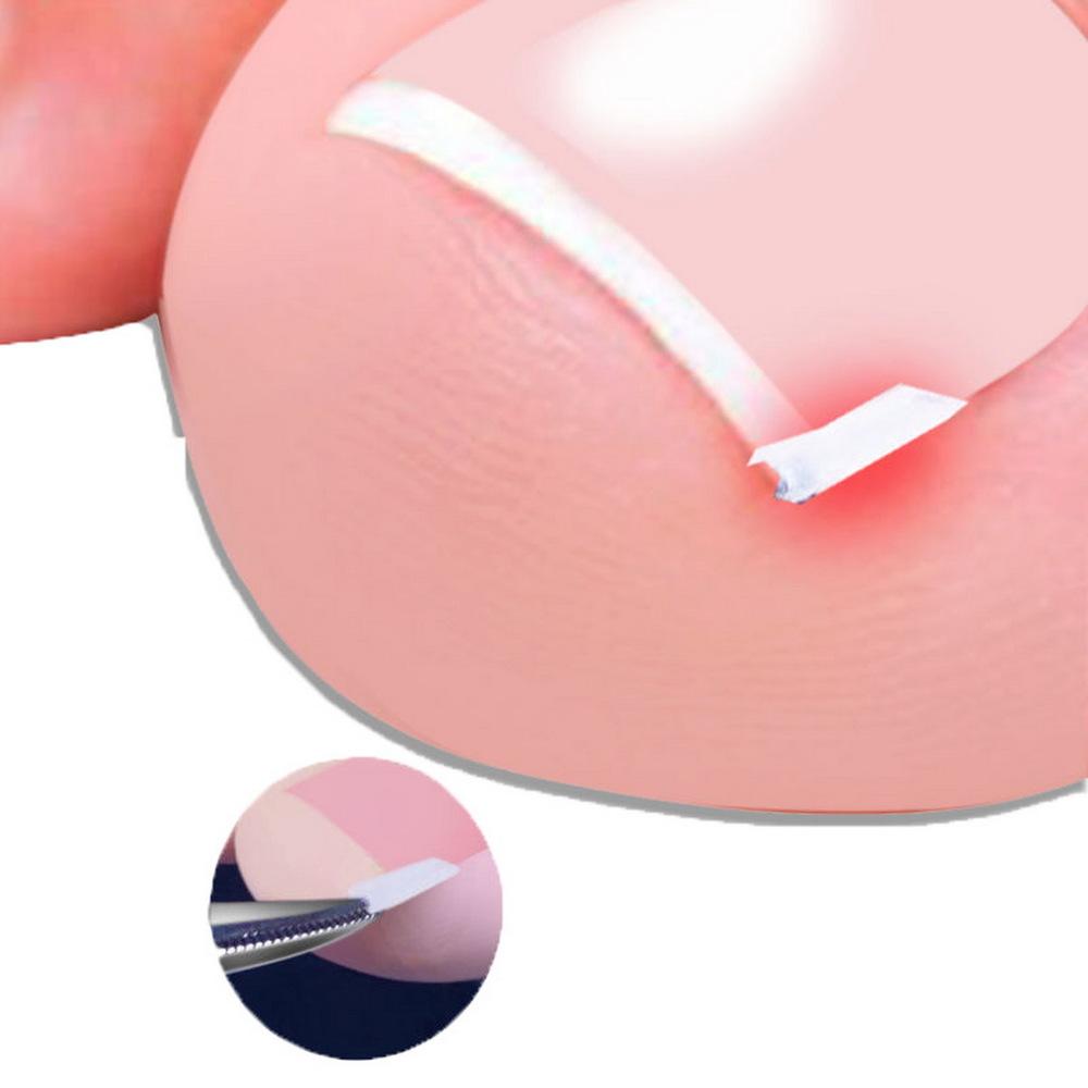 Toenail Correction Tool Toe Nail Treatment Elastic Patch Sticker Straightening Clip Brace Pedicure Tool