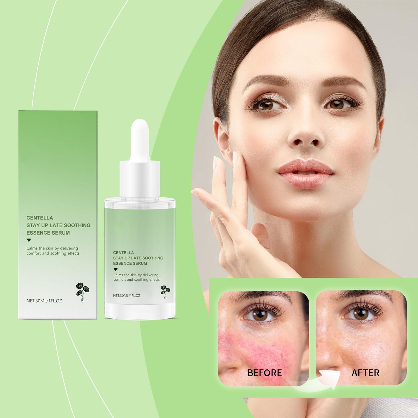 

Snow Grass Soothing Liquid Effectively Alleviates Sensitivity, Redness, Moisturization, And Maintains Barrier Balance,30ML зелений