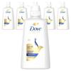 Dove Intense Repair Conditioner 660ml 6 Pcs