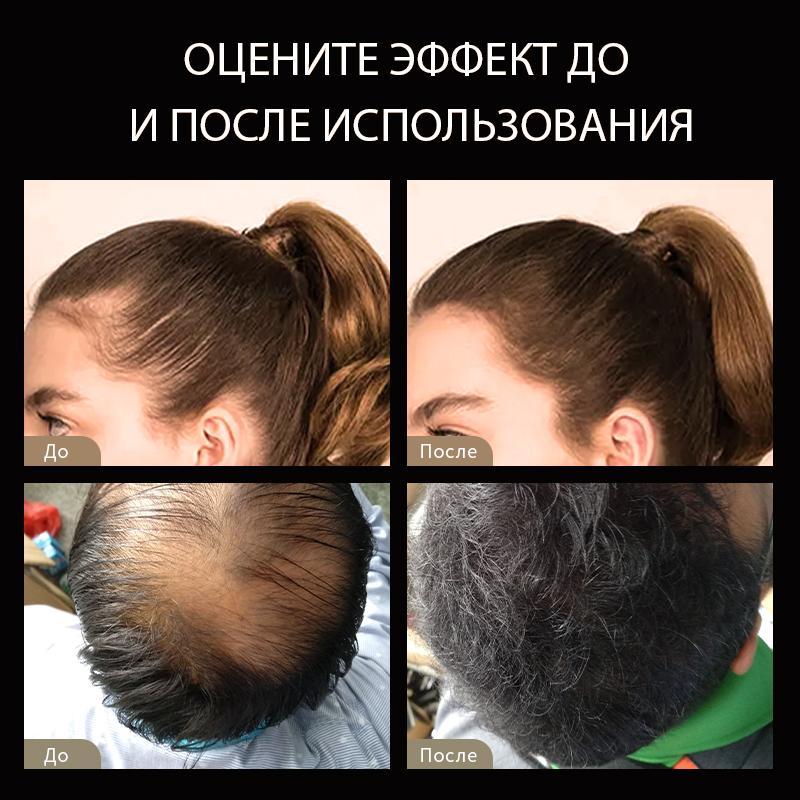 Nozzle Spray Applicator Pump Tool and Sevich Easy Usage Hair Building Fiber Powders New Package for 25g Bottle