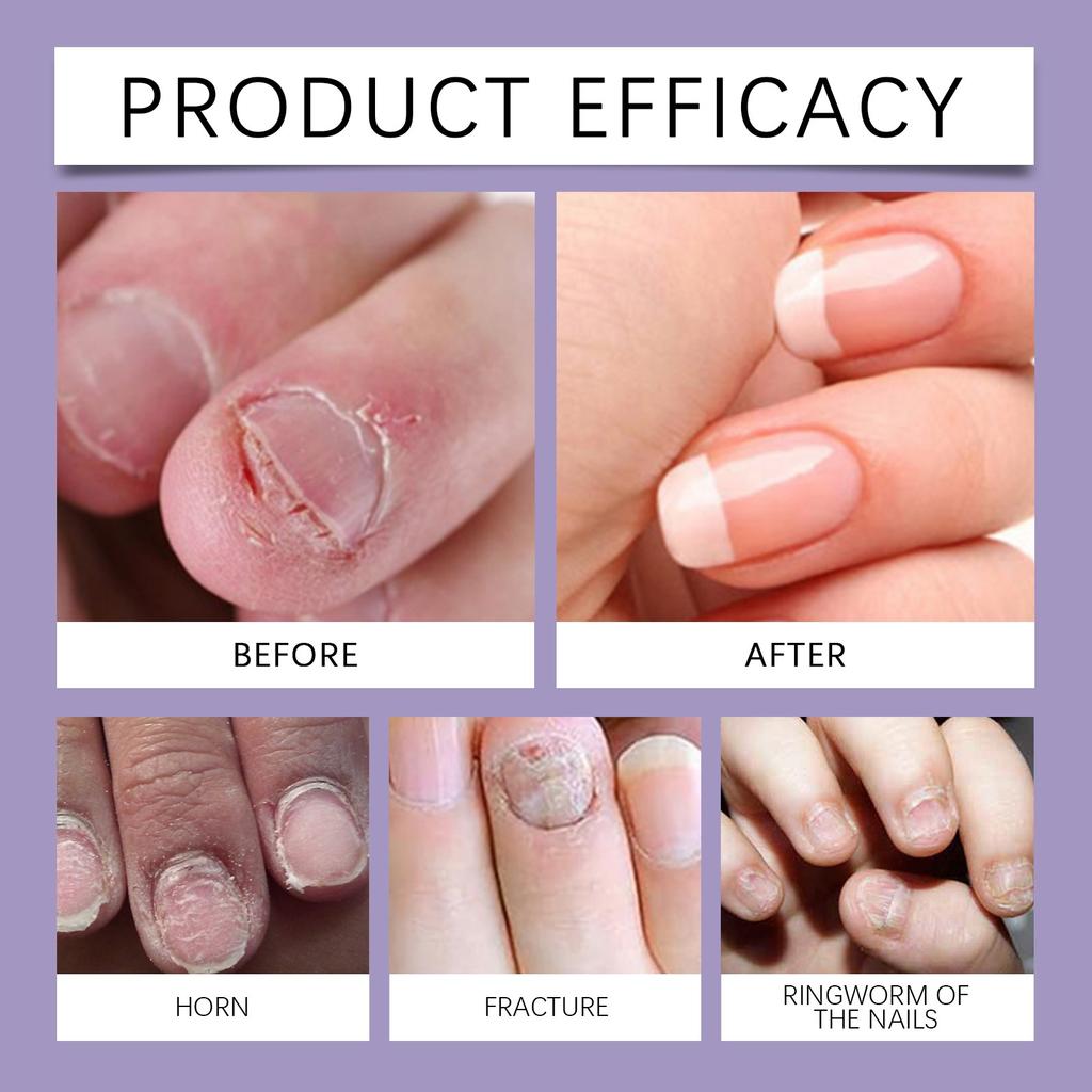 Gel dissolvant pour cuticules des ongles, gel crème adoucissant pour les ongles | Adoucissement des callosités, outils de salon de soins des ongles pour les mains.(30ML)