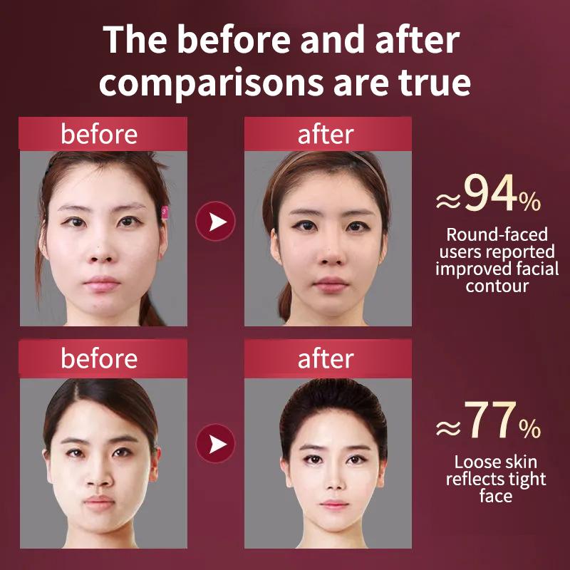 Facial Lifting Device LED Photon Therapy Facial Slimming Vibration Massager Double Chin V-shaped Cheek Lift Face