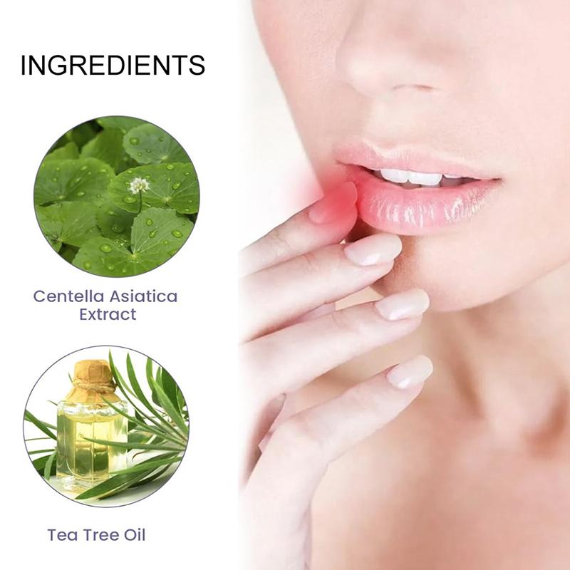 360 Unidades Parche para Ampollas Bucales Parche para Calenturas Labiales Parche para Ampollas Labiales Curación de Calenturas Hidrocoloide Pegatinas para el Cuidado de los Labios Parche para Ampollas Bucales