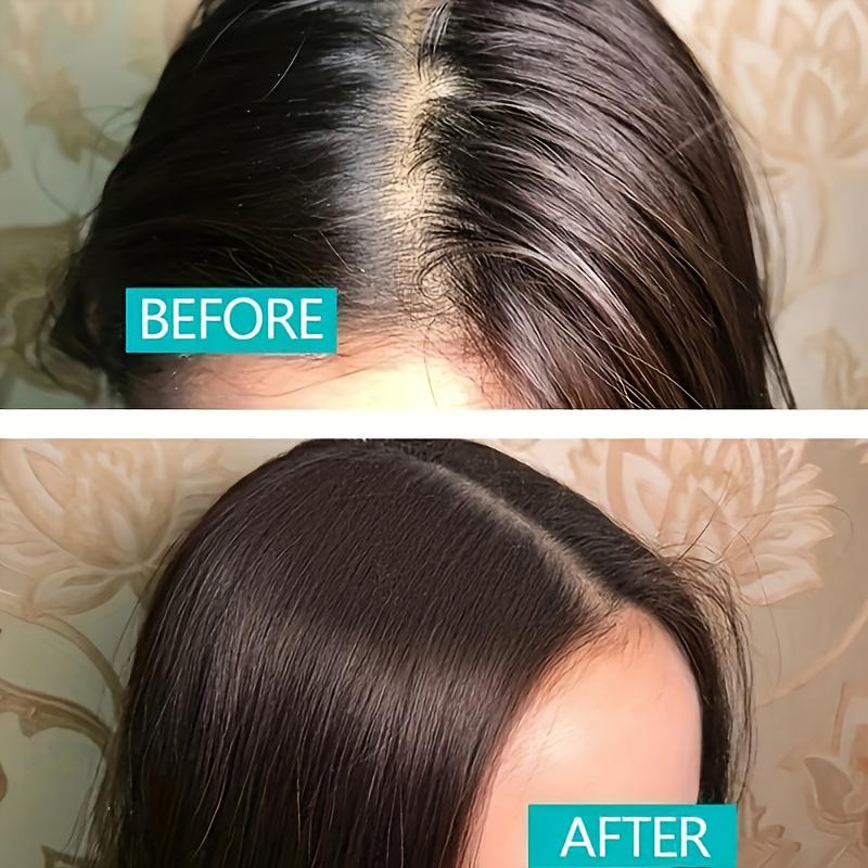 Poudre de shampoing sans rinçage pour cheveux, Spray pour frange, contrôle et élimination de l'huile, poudre pour cheveux secs, nettoyage à sec
