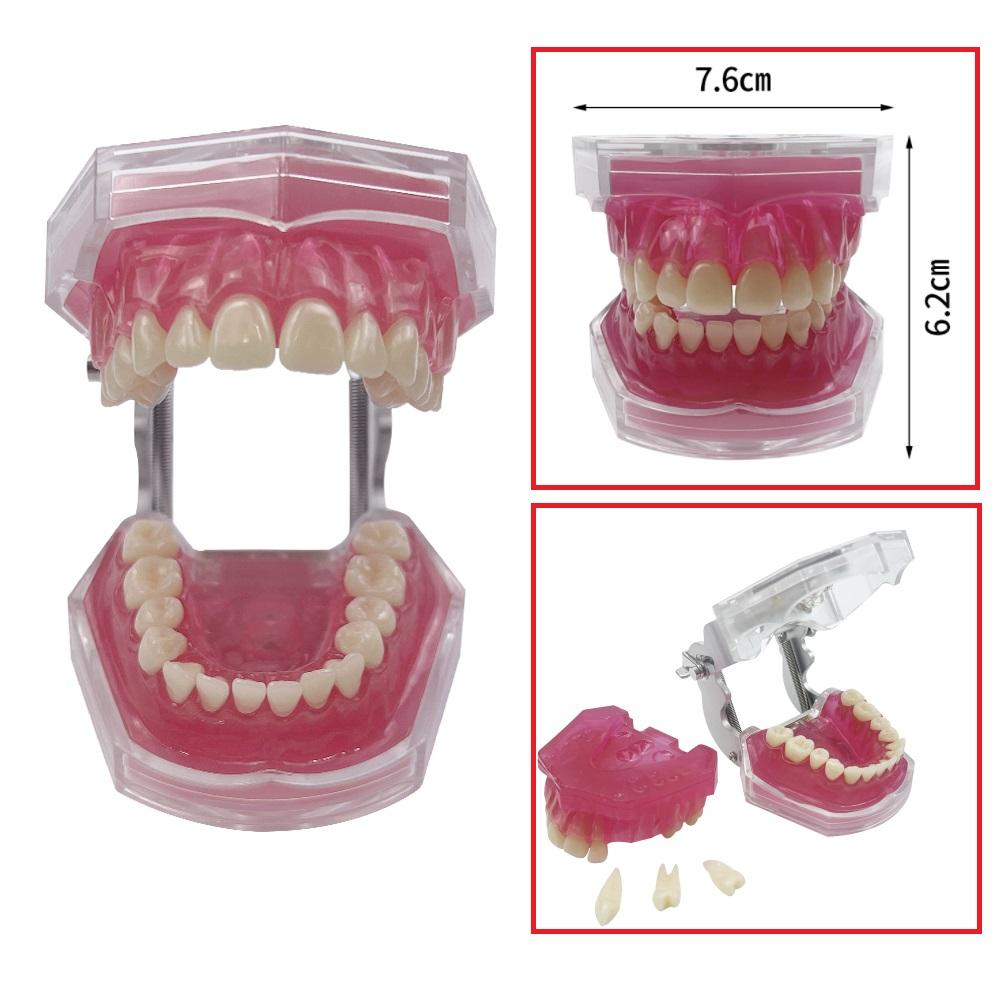 Dental Standard Typodont Model With 28pc Removable Teeth Soft Gum Tooth Extraction Practice Model For Patient Education Demo New