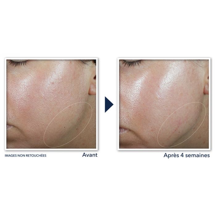 RoC Derm Correxion® Crème Contour 50ml