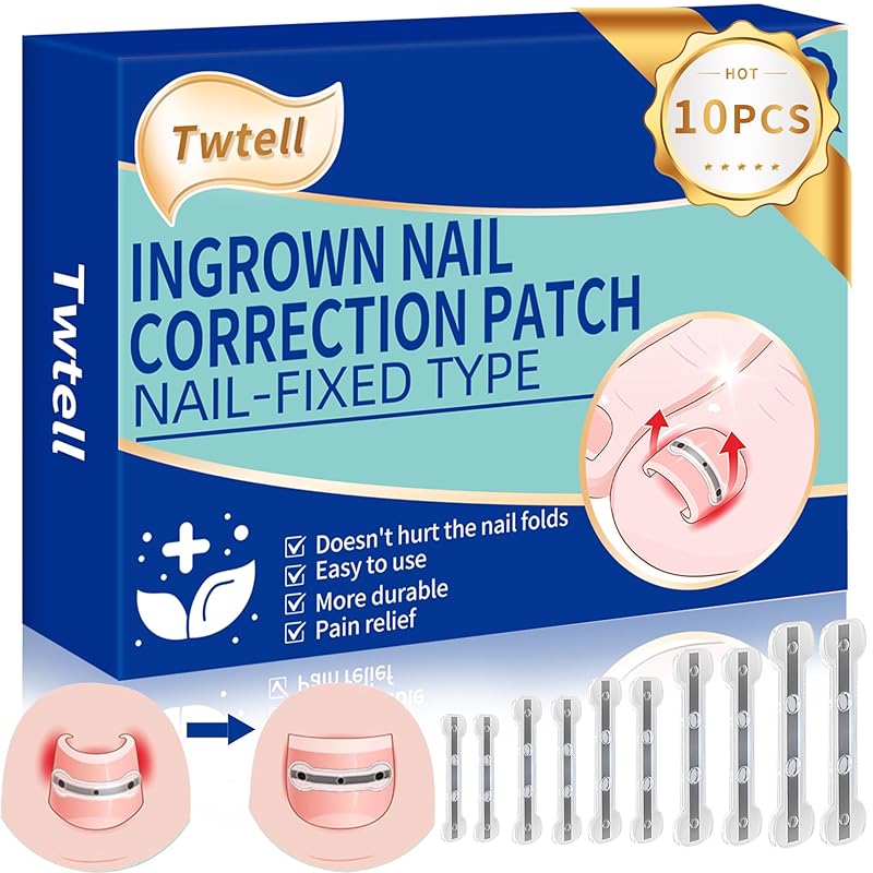 5 Sizes, 10 Pcs - Ingrown Toenail Treatment Kit, Titanium Alloy Ingrown Toenail Removal Kit, Nails Corrector Tool & Remover Strips - Ingrown Toe Nail 10 pack
