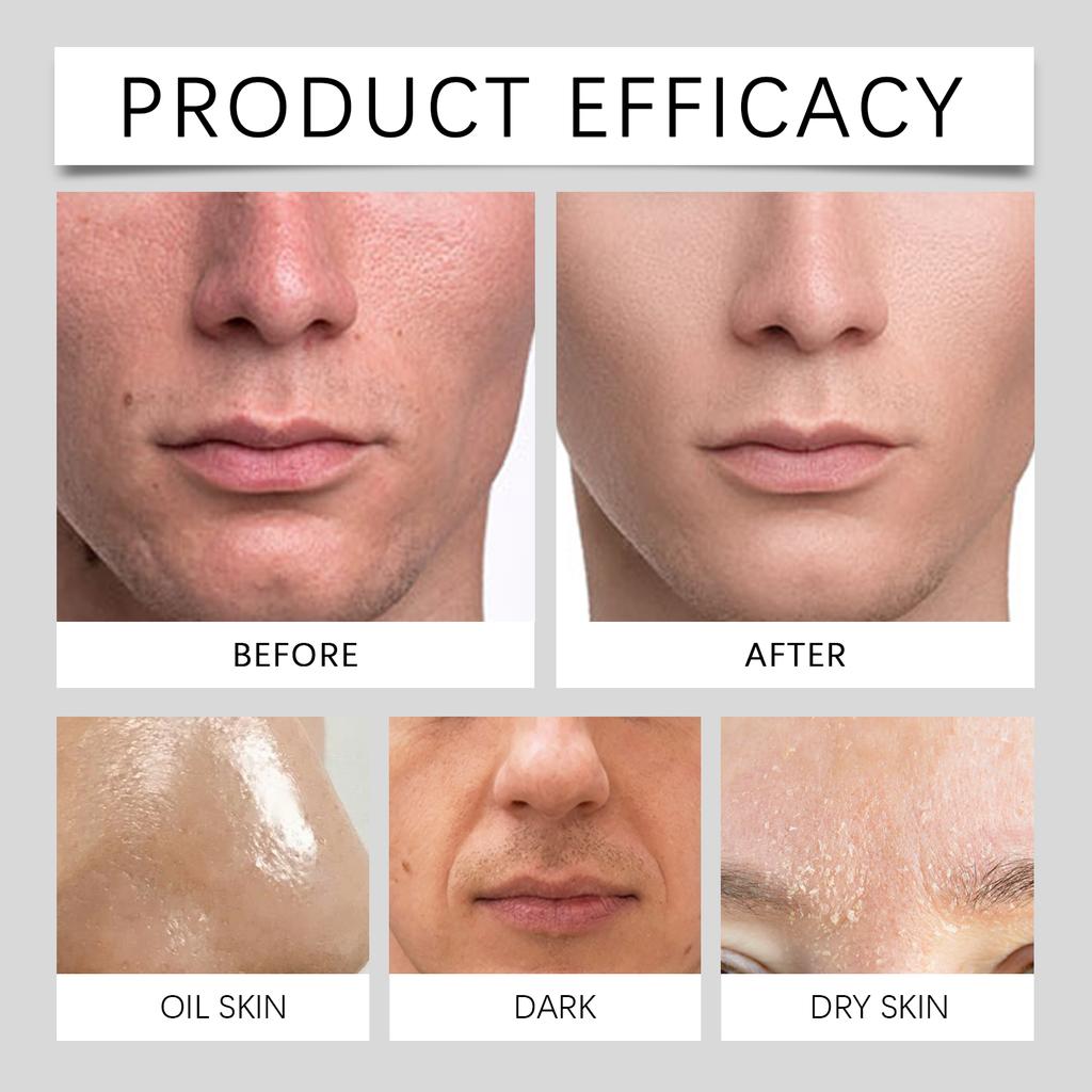 Gentle Moisturizing Cleanser Deeply Moisturizes And Reduces Dirt And Oil On The Skin Surface Suitable For A Variety Of Skin Types