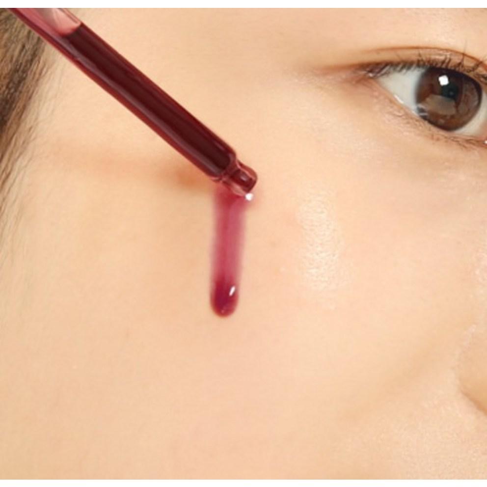 SO NATURAL Red Peel Tingle Serum, 35ml, 1ea