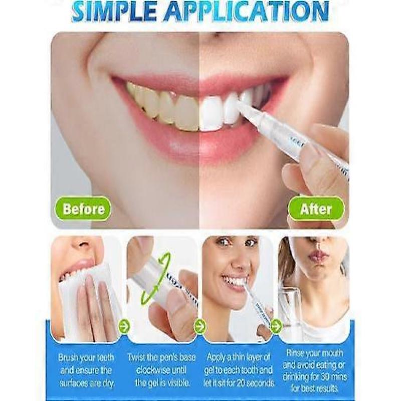 4 Stück Zahnaufhellungsstift, Zahnaufhellungsstift Gel, Zahnaufhellungs-Essenzstift mit Minzgeschmack, Geringe Empfindlichkeit, Frischer Atem, Reisefreundlich