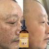5ML/15ML/30ML/50ML/kurkumový olej Hloubkově hydratační séra Rozjasnění vyblednutí Odstranění tmavých skvrn Pigmentová korekce Beauty Face Péče o pleť