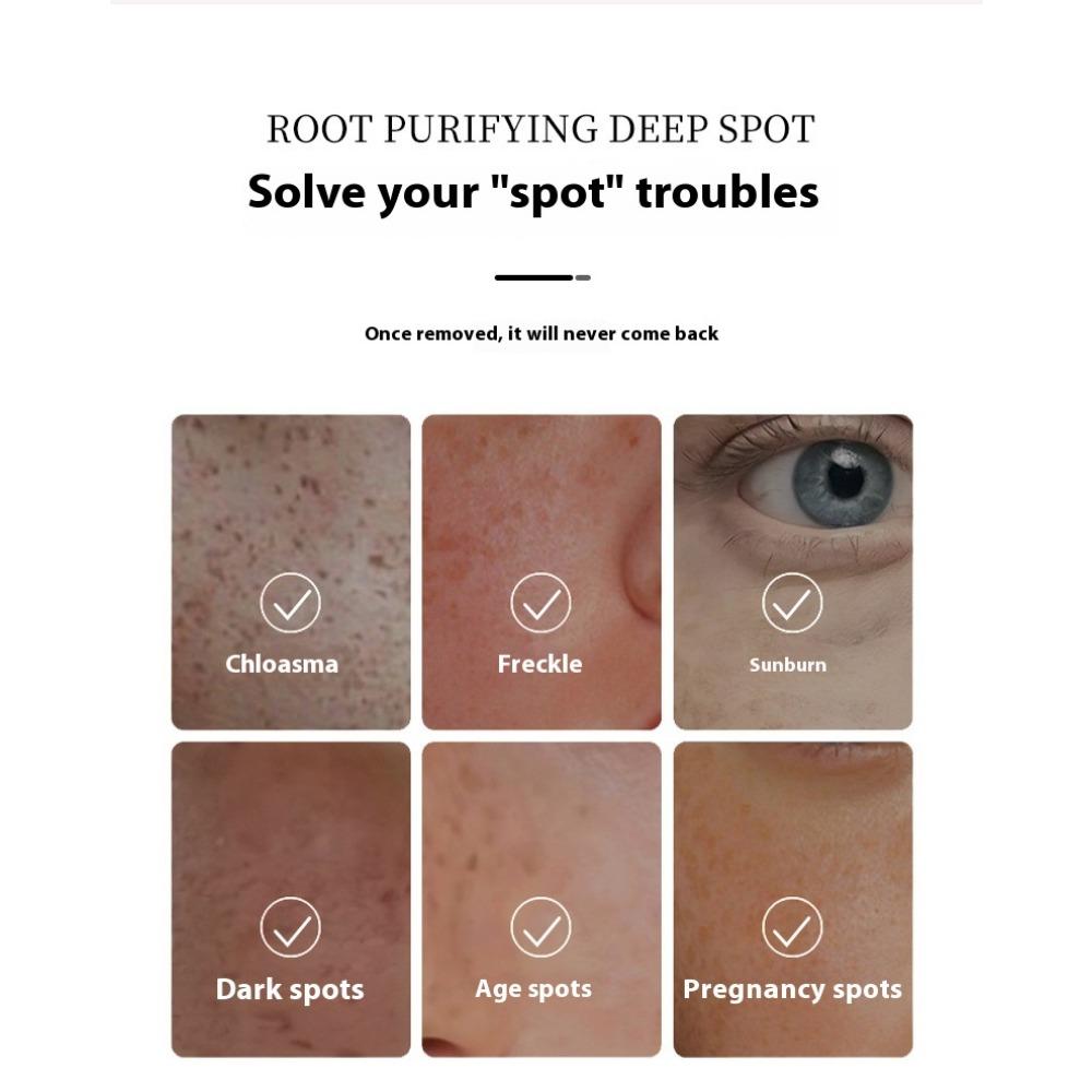 Anti-freckle Cream Whitening Niacinamide Cream Fade Spots Age Spots Anti-wrinkle Cream Moisturizing