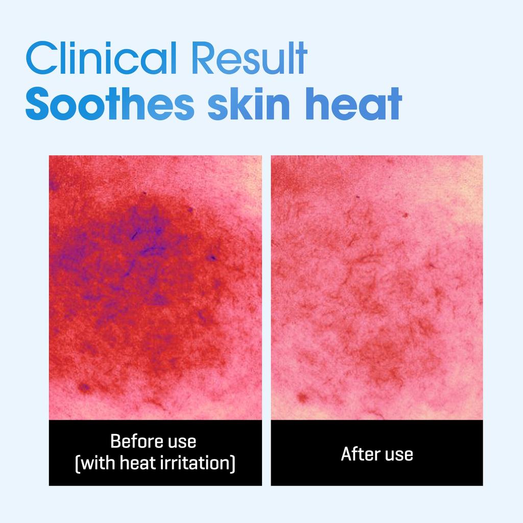 SOME BY MI Beta Panthenol Repair Daily Mask Nourishing Skincare for Dry Skin and Hydrating At Home Sheet Moisturizing Korean Cosmetics (30 Sheets,