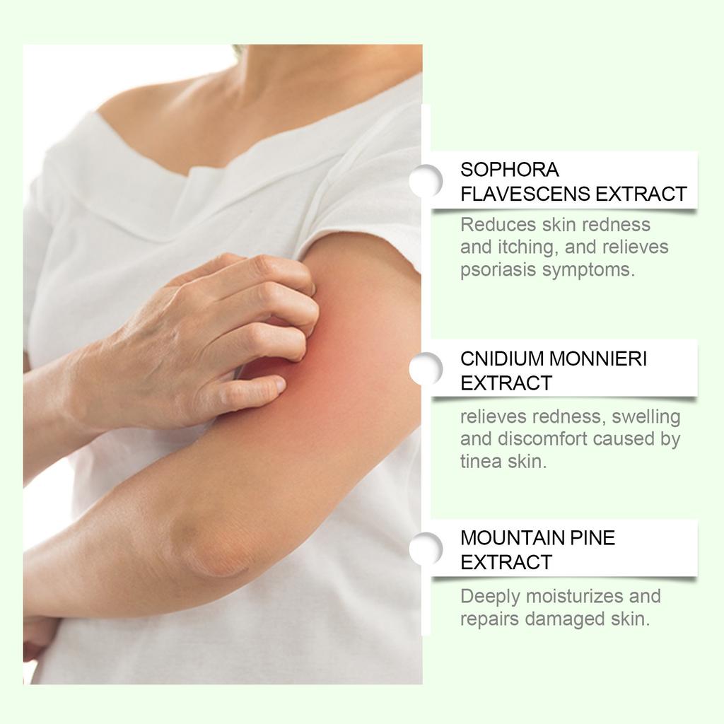 Anti-itch Repairing Cream For ,Skin Care Cream, Gentle Herbal Skin Body Care Moisturizes And Nourishes Skin Moisture