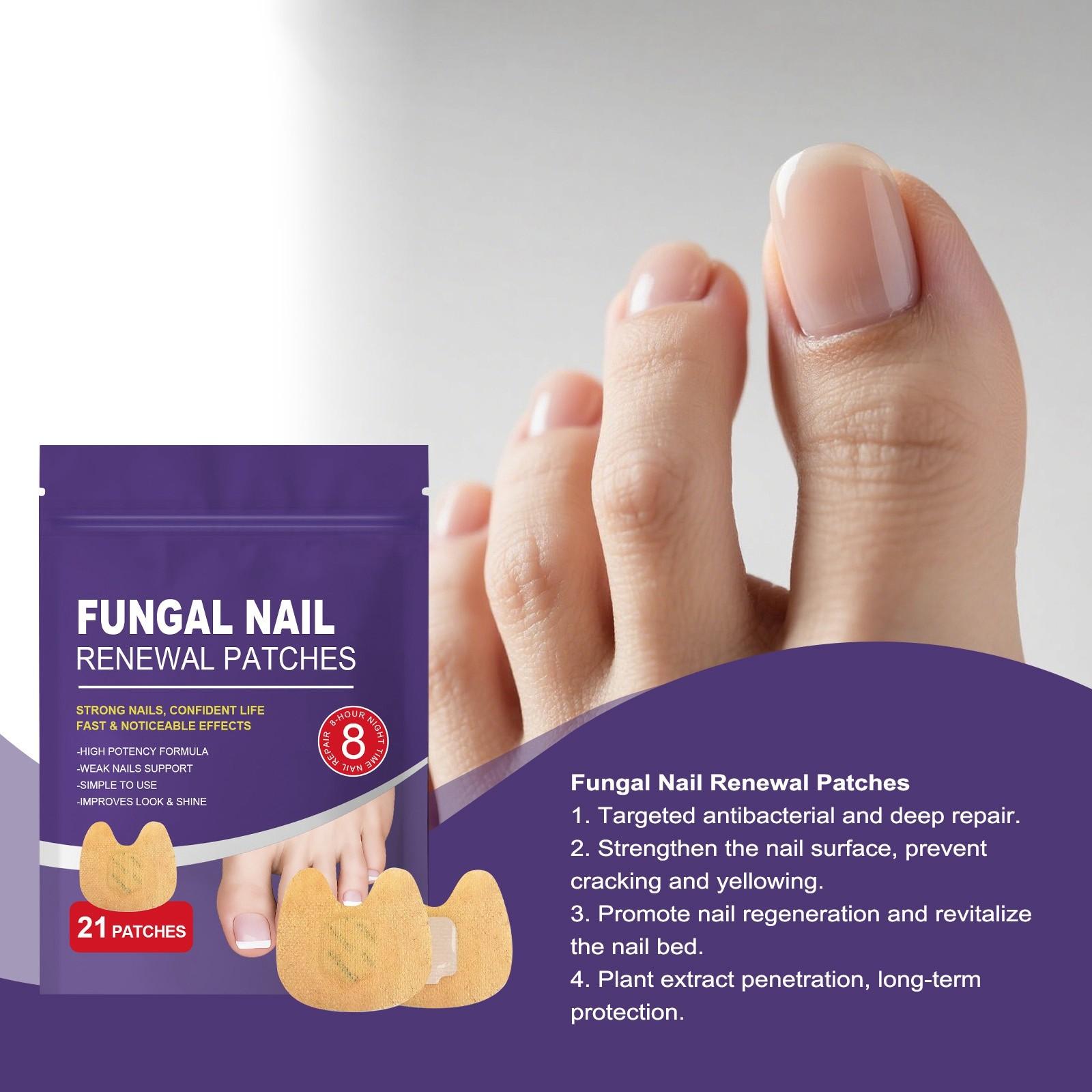 

Крепкие пластыри от грибка ногтей, пластыри для ухода за ногтями, ночные пластыри от грибка ногтей, грибок ногтей 21 шт/пакет One Size белый