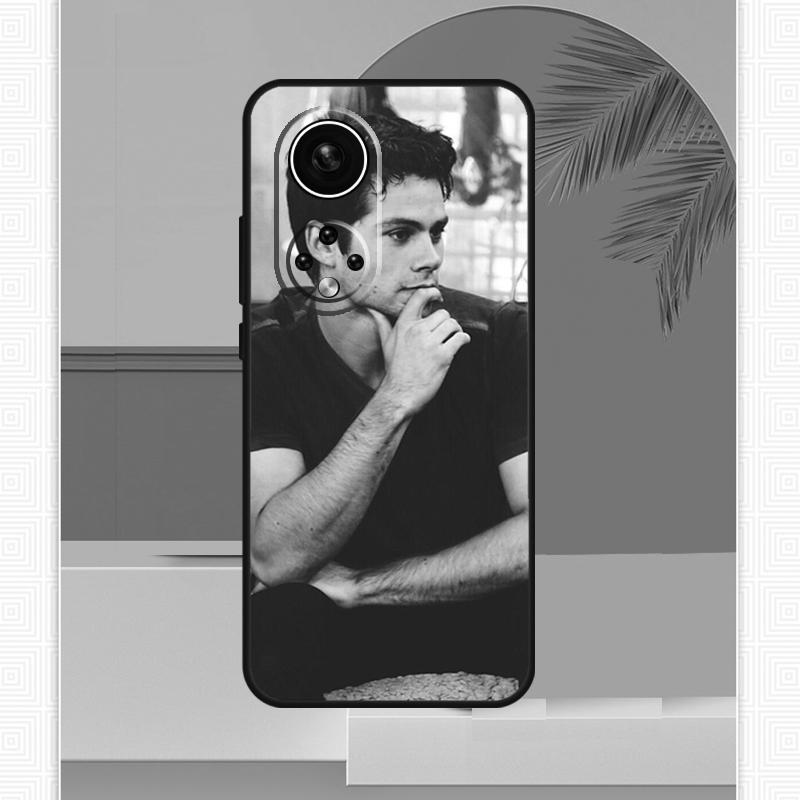 Dylan O'Brien Teen Wolf Case For Honor Magic 5 6 7 8 Pro Honor X9c X9b X9a X8b X8a X8c 50 70 90 400 200 Lite Cover