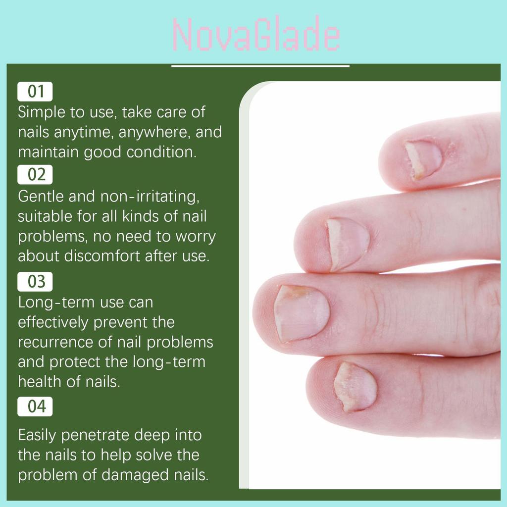 Nourishing South Moon Nail Repair Liquid For Healthy Strong Shiny Nails And Cuticle Care