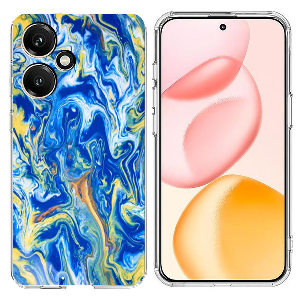 For Honor 400 5G (Global) Case Marble Pattern Printing Soft TPU Phone Cover