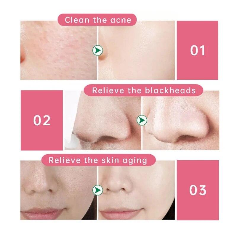 30pcs Organic Natural Silk Cocoons Cleanser Silkworm Balls Scrub Purifying Acne Anti Aging Whitening Cleaning Face Care