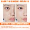 15ml Face Cream Anti-aging Natural Mild Freckle Removal Cream Pen for Ladies