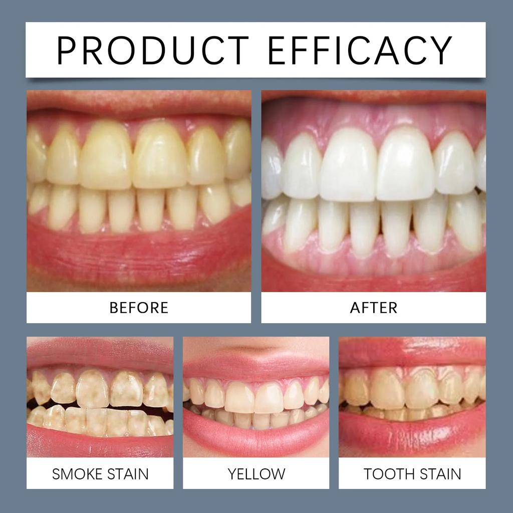 Hydroxyapatite Mint Toothpaste Teeth Yellow Stains Remove Remove Bad Breath Prevent Tooth Decay  Cleaning Brightening Oral Care