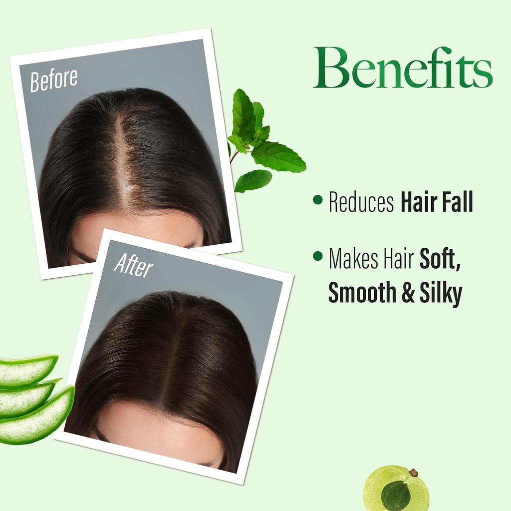 Kesh King Anti-Haarausfall Shampoo mit Aloe Vera und 21 ayurvedischen Kräutern für alle Haartypen Frauen Männer 340ml Nährende Formel