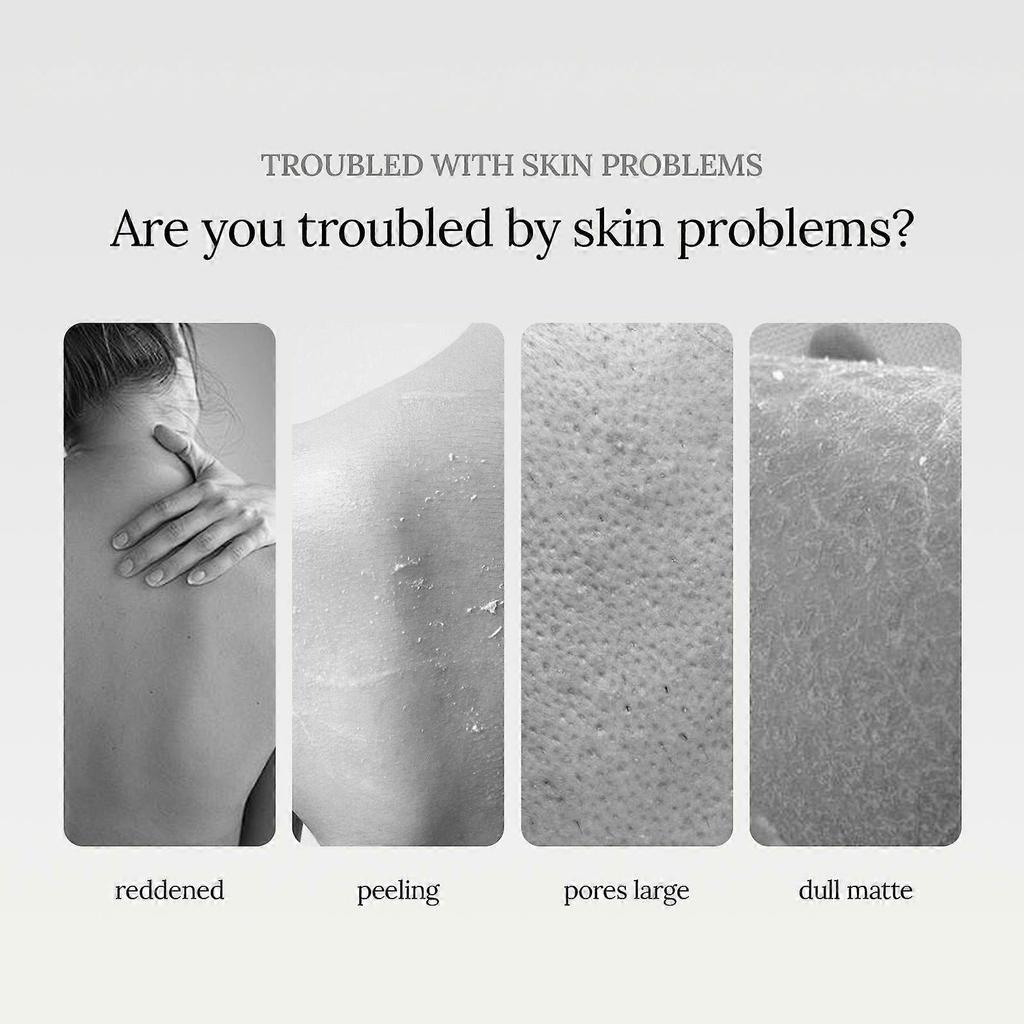 Eelhoe Niacinamide Scented Body Wash (Silver Mountain Spring) Cleanses The Body, Brighens The Skin Tone, Refines Pores, And Moisturizes And Repairs