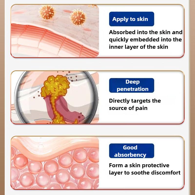 Special Shu ointment for varicose veins to treat blood vessel blockage and dredge in the legs