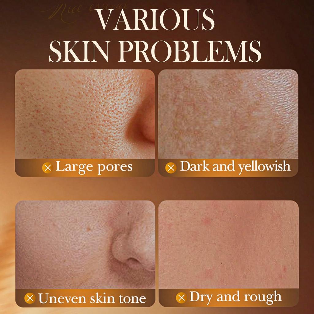 70 Rice Whitening Cream Brightens Dull Skin Moisturizes and Evens Complexion for a Radiant Glow