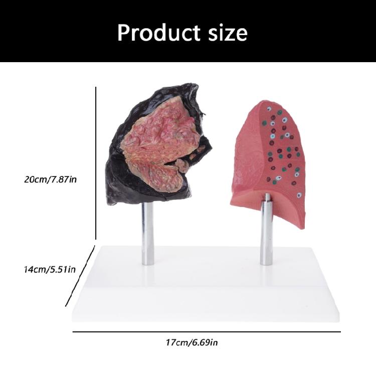 Anatomically Accurate Smoker Lung Comparison Model With Healthy Lung PVC Substance For Clinical Education