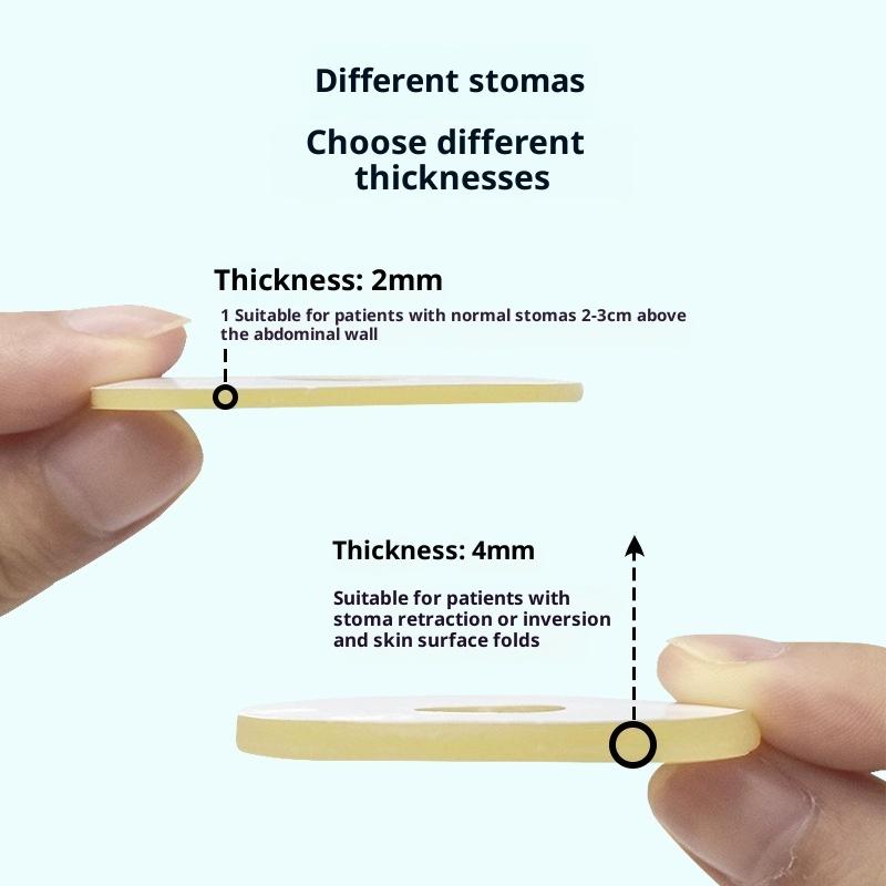 10Pcs Anti-Leakage Leak-Proof Ring For Colostomy Bag Ostomy Paste Ring Baseplates Stoma Care Products To Protect Skin 2/4Mm