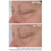 Strivectin Hyaluronic Tripeptide Gel Cream For Eyes 0.5 Oz