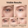 Patchs Oculaires à Microneedles pour Cernes et Poches - Eye Hydrogel pour