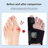 Micro-Current Toe Separator EMS Big Toe Straightener Correction Device Feet Valgus Correcto  Women