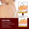 Tags & Moles Remover, WipeOff Tags & Moles Remover, WipeOff Remover 3ML