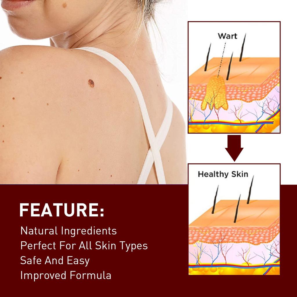 Tags & Moles Remover, WipeOff Tags & Moles Remover, WipeOff Remover 3ML