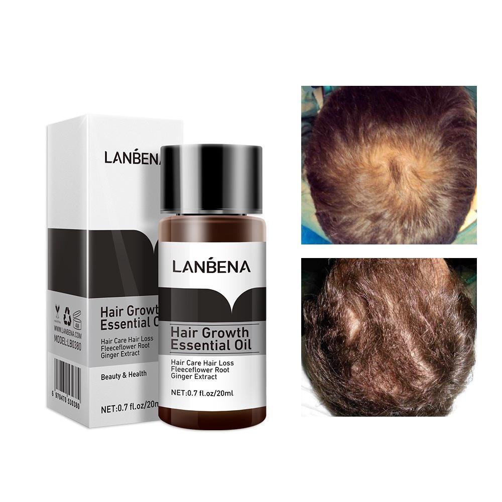 20ml Hair Care Essential Oil, Natural Ingredients, Deep Nourishment of Hair, Promote Hair Growth, Unisex