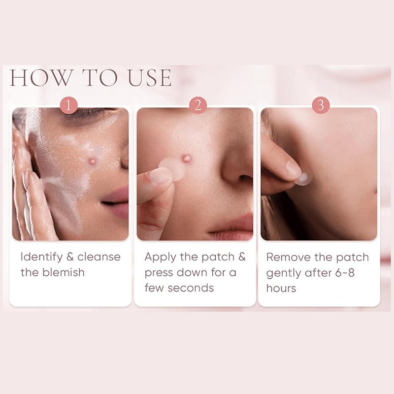 540Pcs Face Skin Care Acne Pimple Patch Invisible Professional Healing Absorbing Spot Sticker Covering For Men Women